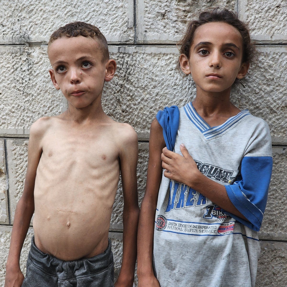 We faced hunger before, but never like this': skeletal children fill  hospital wards as starvation grips Gaza | Gaza | The Guardian