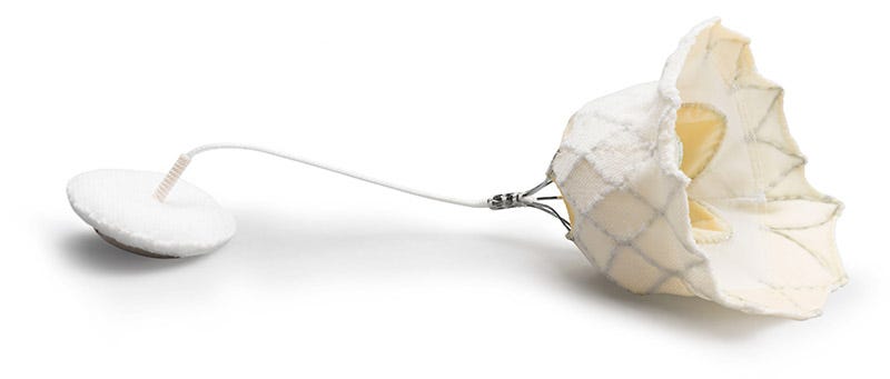 Tendyne Transcatheter Mitral Valve Replacement | Abbott