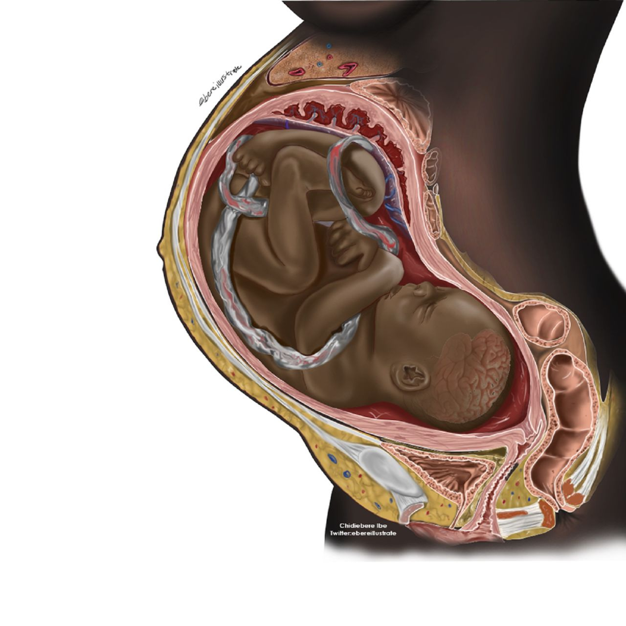 Illustrazione di un feto nero nella pancia della madre Illustrazione di un feto nero nella pancia della madre
