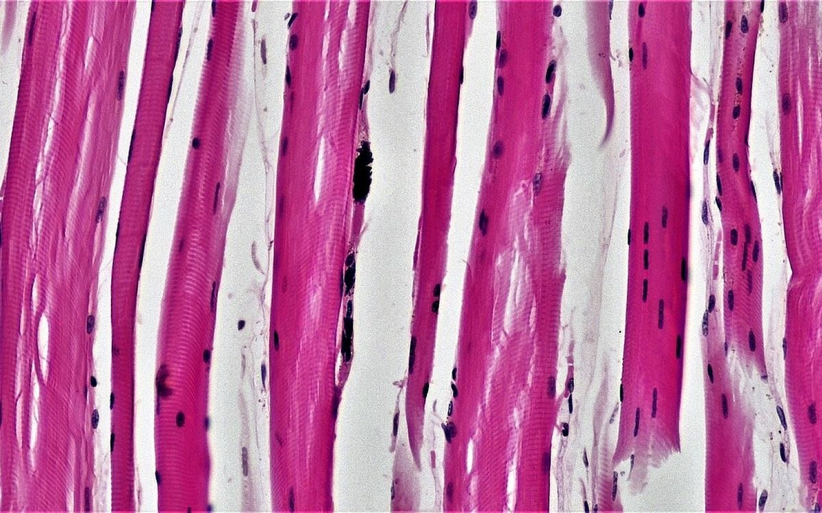 Skeletal muscle fibers under the microscope Skeletal muscle fibers under the microscope