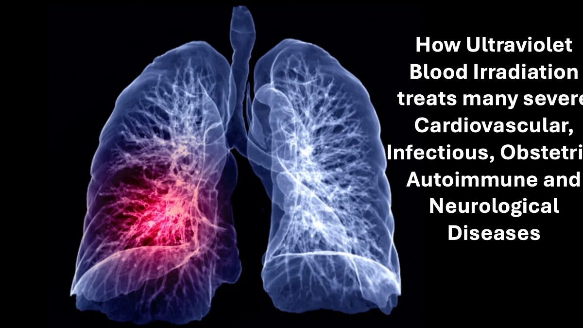 The Century of Evidence Putting Light Inside the Body Is A Miraculous Therapy