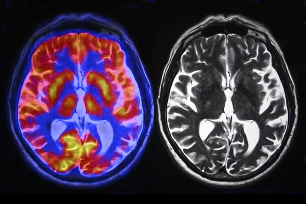 How AI Affects Your Brain According to the Studies: A (Very Big ...