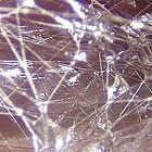 Living Fascia