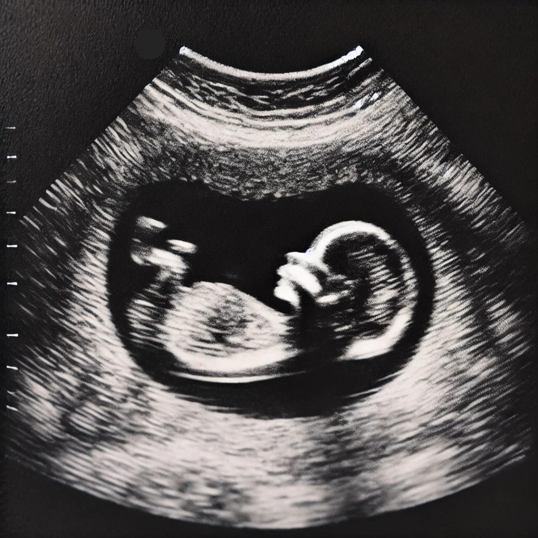 A picture of an 8 week old fetus.