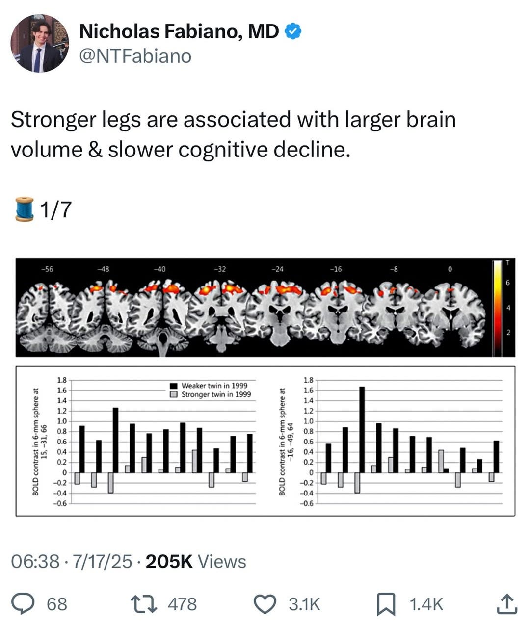 Surprising Connection Between Leg Strength and Brain Health Surprising Connection Between Leg Strength and Brain Health
