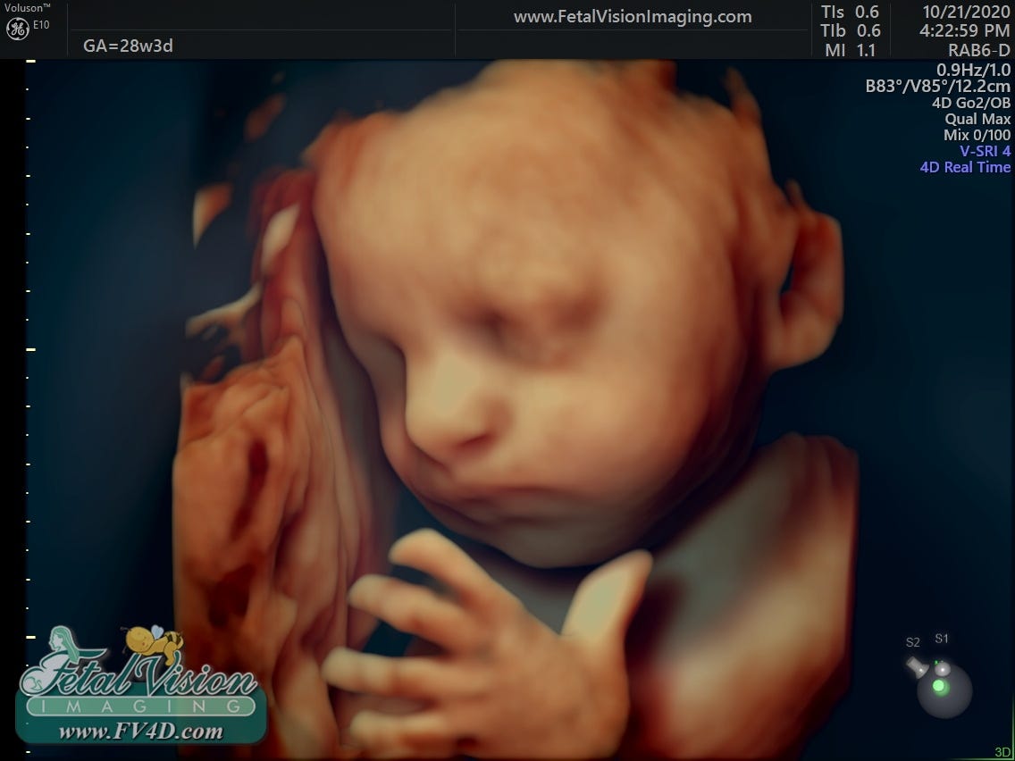 The Latest Advancements in Ultrasound Technology