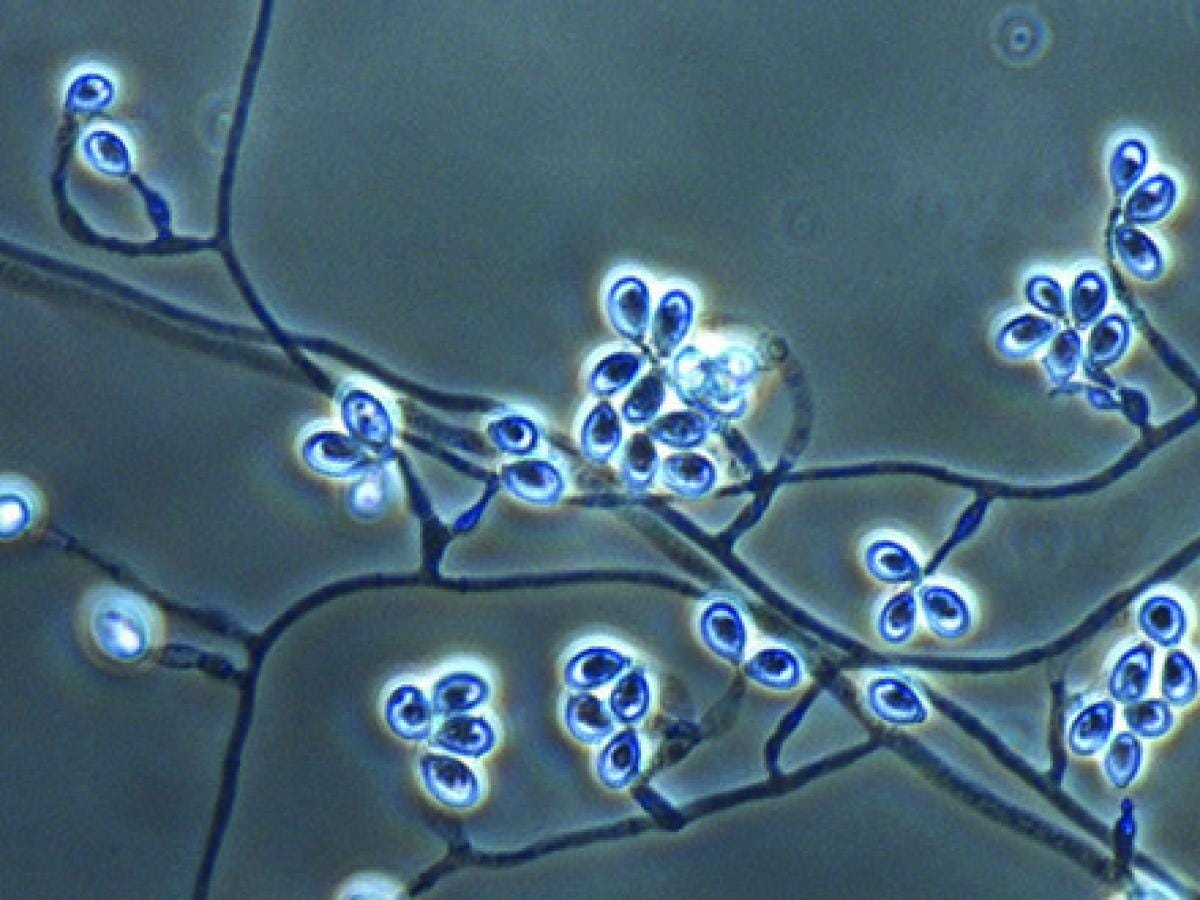 Lomentospora prolificans | Mycology | University of Adelaide