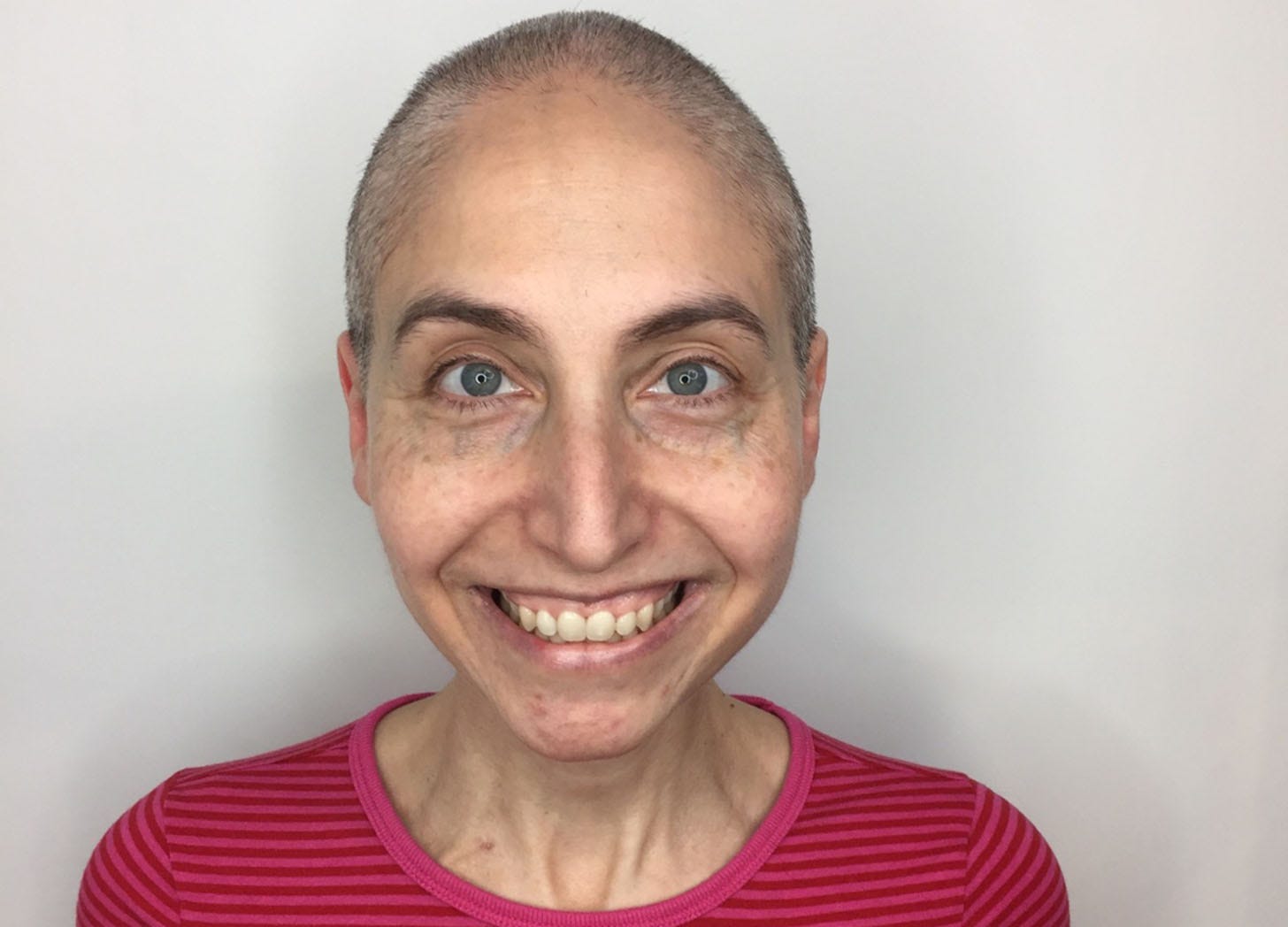 Closeup photo of me at the salon after getting my head shaved
