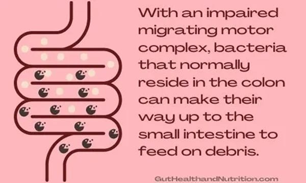impaired migrating motor complex impaired migrating motor complex