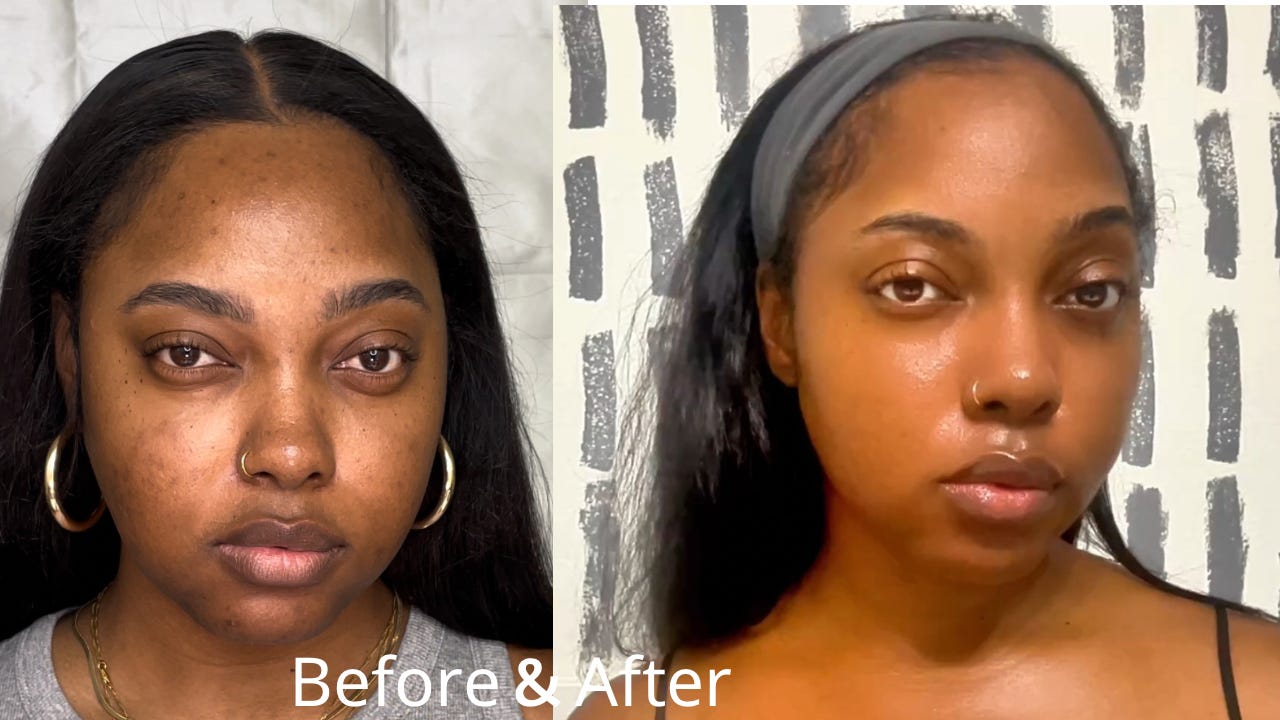 before and after of black woman skincare transformation before and after of black woman skincare transformation
