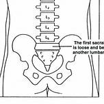 Beyond Back Pain with Sarah Key