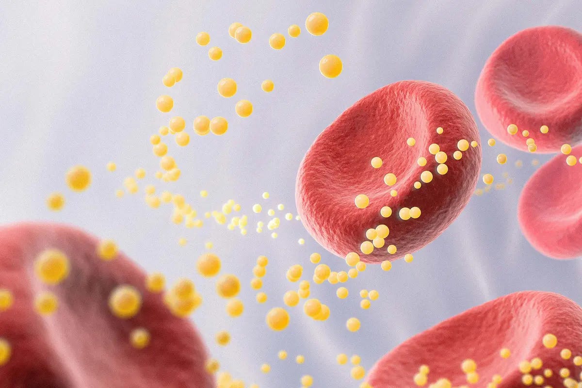 Is High Cholesterol Really Bad for You? It Depends