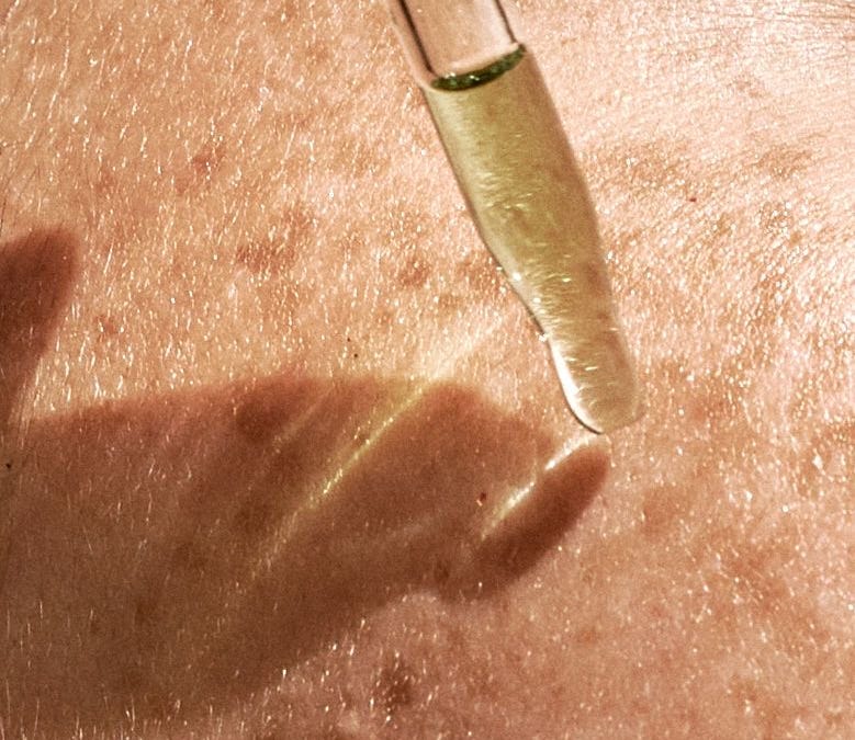 How Skin Needling Treatment Fits into a Professional Skin Care Plan 
