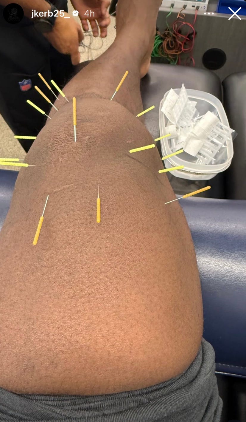Kerby Joseph knee receiving needling therapy Kerby Joseph knee receiving needling therapy