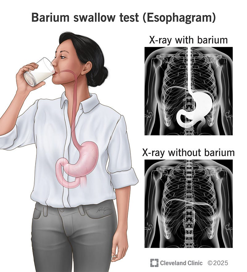 Barium Swallow Test (Esophagram): What It Is & Why It's Done Barium Swallow Test (Esophagram): What It Is & Why It's Done