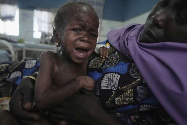 Children die as USAID aid cuts snap a lifeline for the world's most  malnourished | AP News