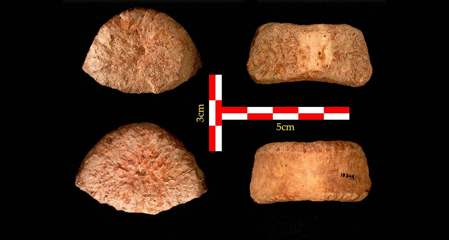 Four images of a vertebral body from different angles