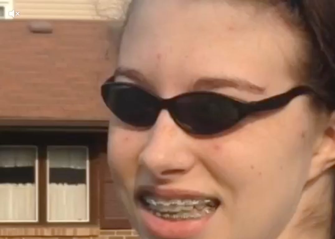 Vine braces girl Vine braces girl