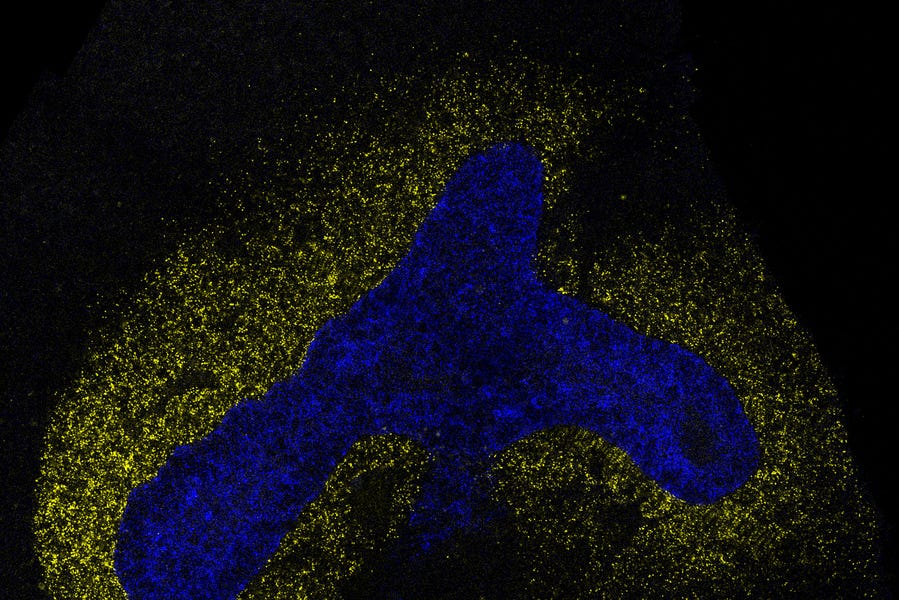 Microscopic image of cells stained blue in a boomerang-like shape, surrounded by cells stained yellow, all on a black background Microscopic image of cells stained blue in a boomerang-like shape, surrounded by cells stained yellow, all on a black background