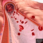 COVID Vaccinated Could Shed Lipid Nanoparticles, Spike Protein Through Blood Transfusion, Breastmilk, Organ Transplantation, Exhalation, Skin-to-Skin Contact: New Preprint Study