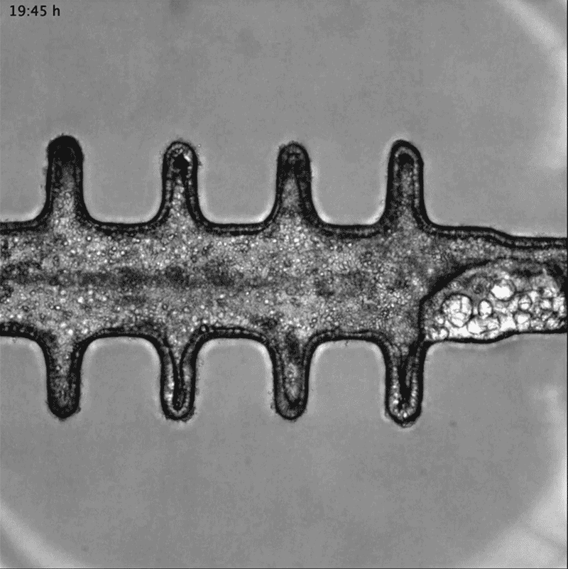 Animated sequence from a video showing mini-colon oncogenesis. Animated sequence from a video showing mini-colon oncogenesis.