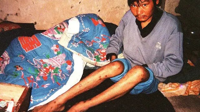 王淑平：揭露中国“血祸”和艾滋疫情的医生- BBC News 中文