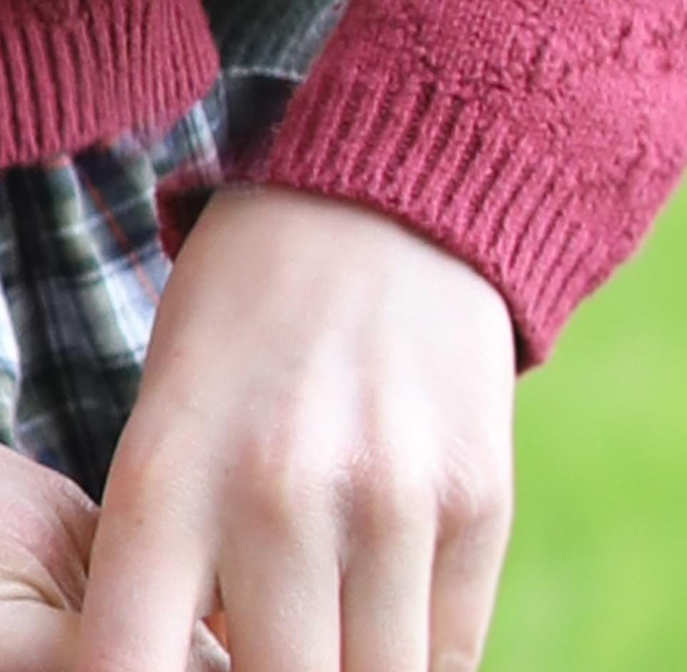 1) Charlotte's hand - Empty space where sleeve should be