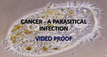 PARASITES AND CANCER