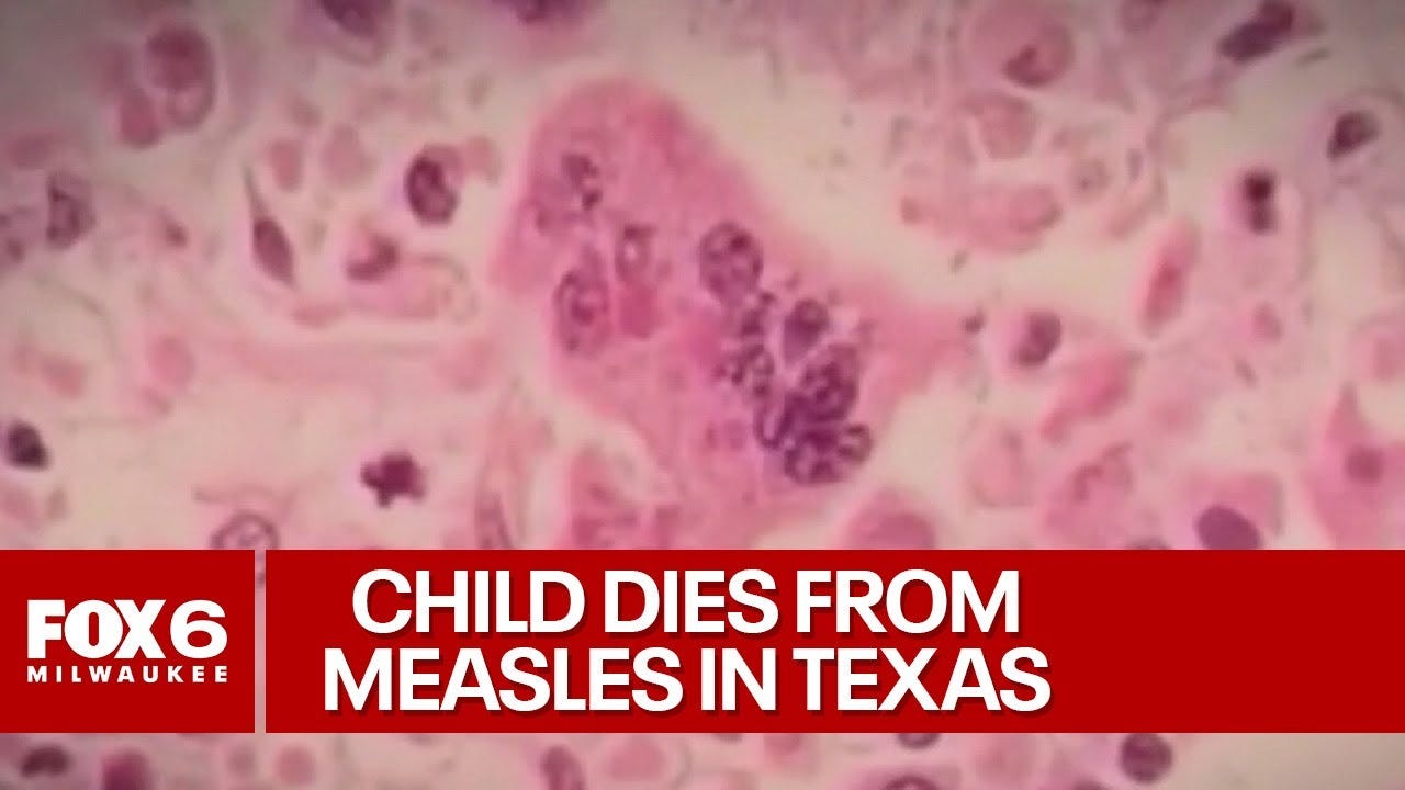 Measles outbreak in Texas, 1 child dies | FOX6 News Milwaukee