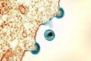 Transmission electron micrograph of HIV-1 virus particles from infected H9 cells, produced in cell culture. The particles exhibit two stages of replication: the two “arcs” are immature particles budding from the plasma membrane of the cell, and the center spherical particle is a mature form in extracellular space. Image captured at the NIAID Integrated Research Facility (IRF) in Fort Detrick, Maryland.