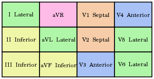Electrocardiography - Wikipedia
