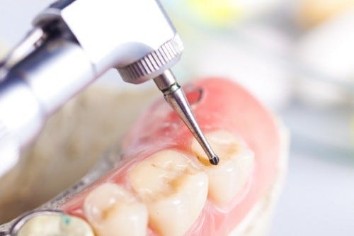 5 Fascinating Dental Drill Facts