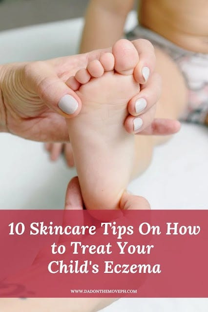 How to manage and treat your child's eczema