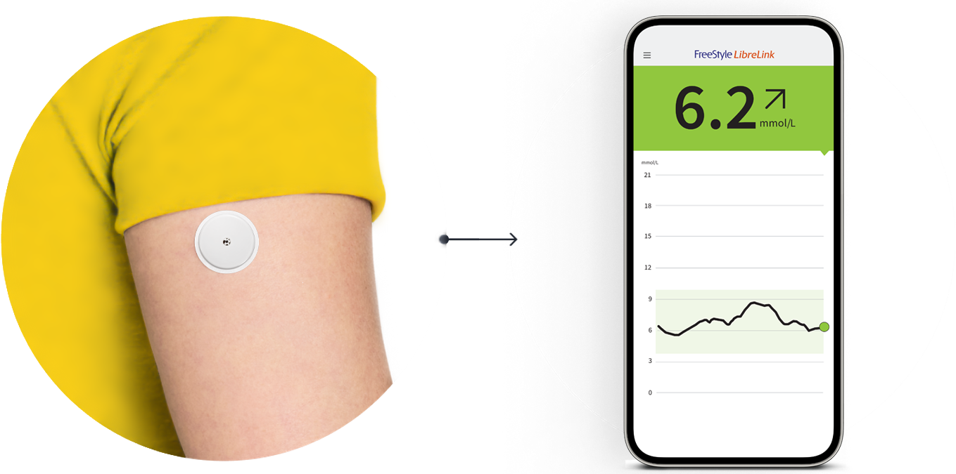 The Libre 3 sensor on the arm of an individual and a view inside the app that tracks their glucose level.