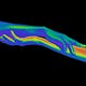 Heatmaps