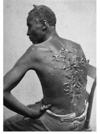 A person with a broken back

AI-generated content may be incorrect.