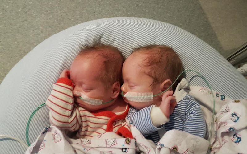Triplets: twins survived