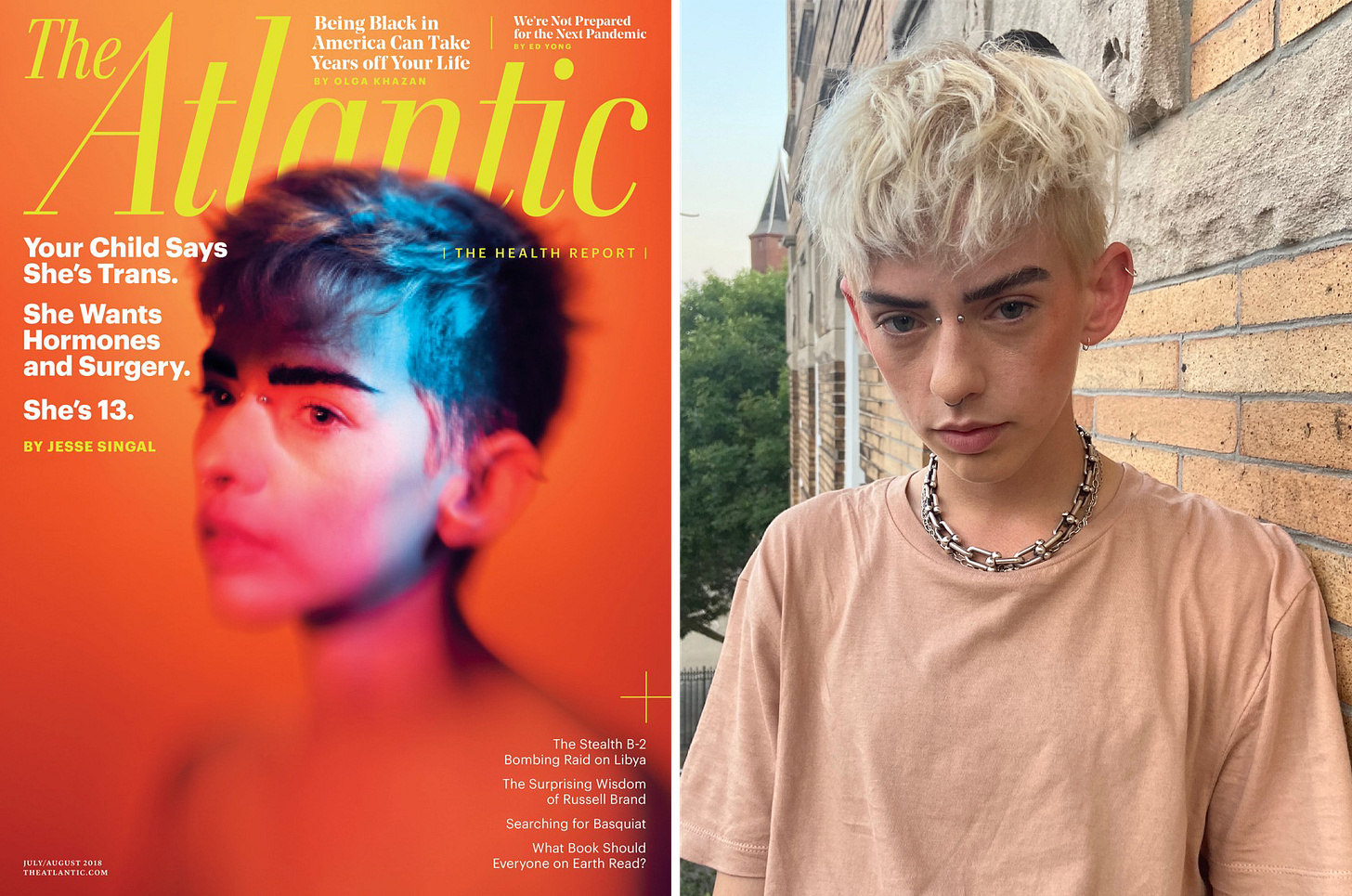 The Atlantic tried to artistically show gender dysphoria on its cover. Instead it damaged the trust of transgender readers. - Poynter The Atlantic tried to artistically show gender dysphoria on its cover. Instead it damaged the trust of transgender readers. - Poynter