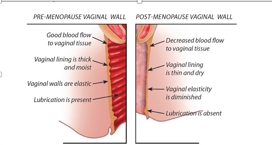 lack of vaginal lubrication Tummy Control Swimsuits | Slimming One-Pieces main image 1