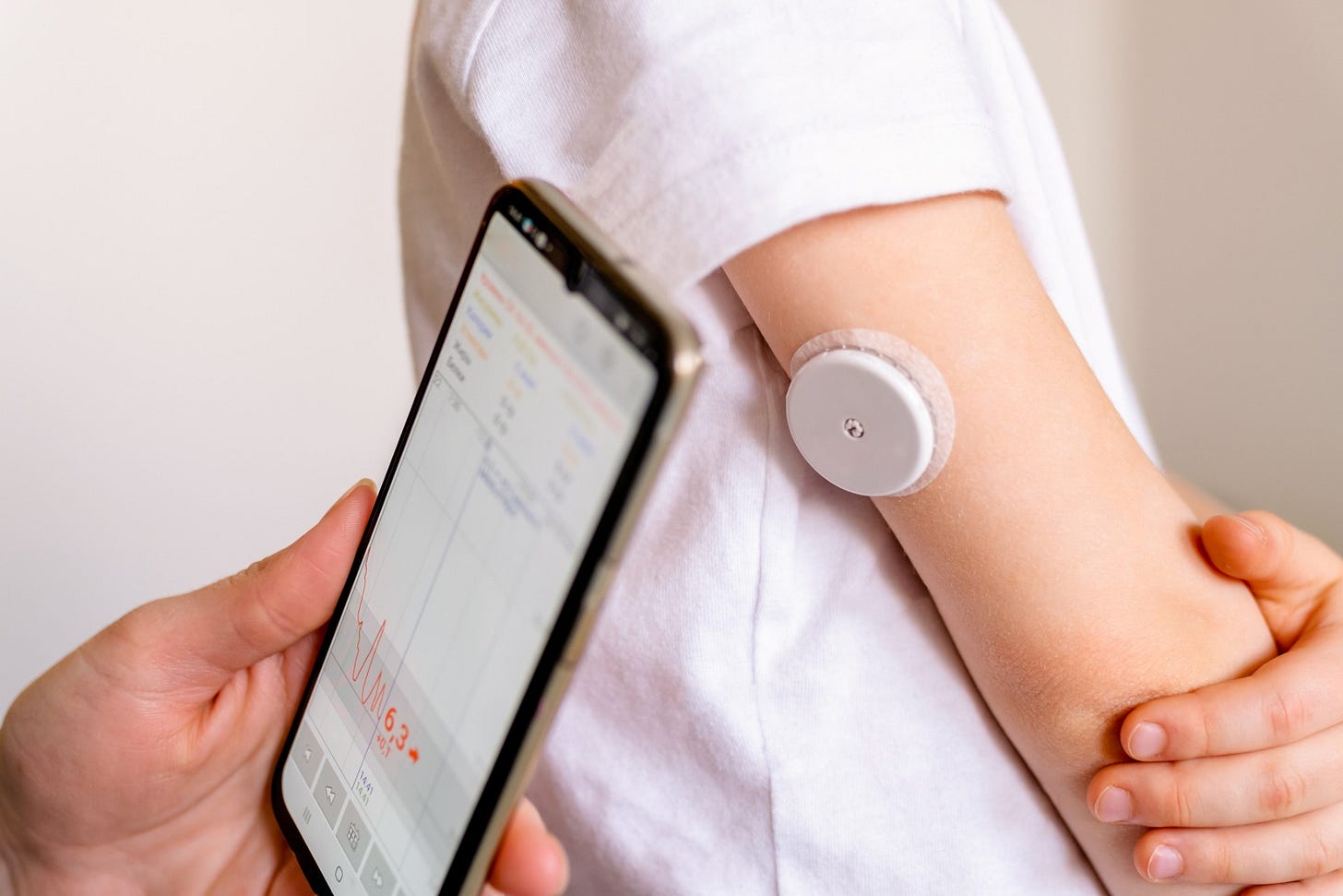Benefits of Using a Continuous Glucose Monitor | Aptiva Medical