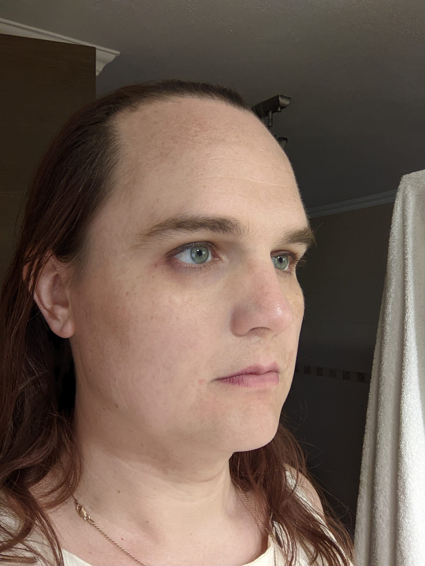 Doc Impossible, the night before surgery. She has a very pronounced brow bone and sharply-receded hair.