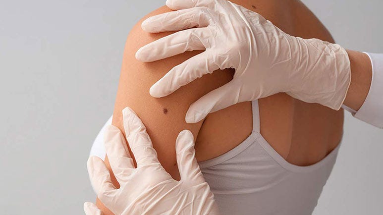 niacinamide reduce skin cancer risk