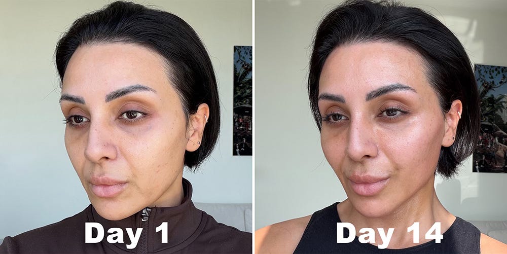 ZIIP Halo 2.0 before and after results