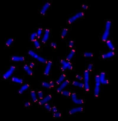An Electron Micrograph Showing Telomeres in Red