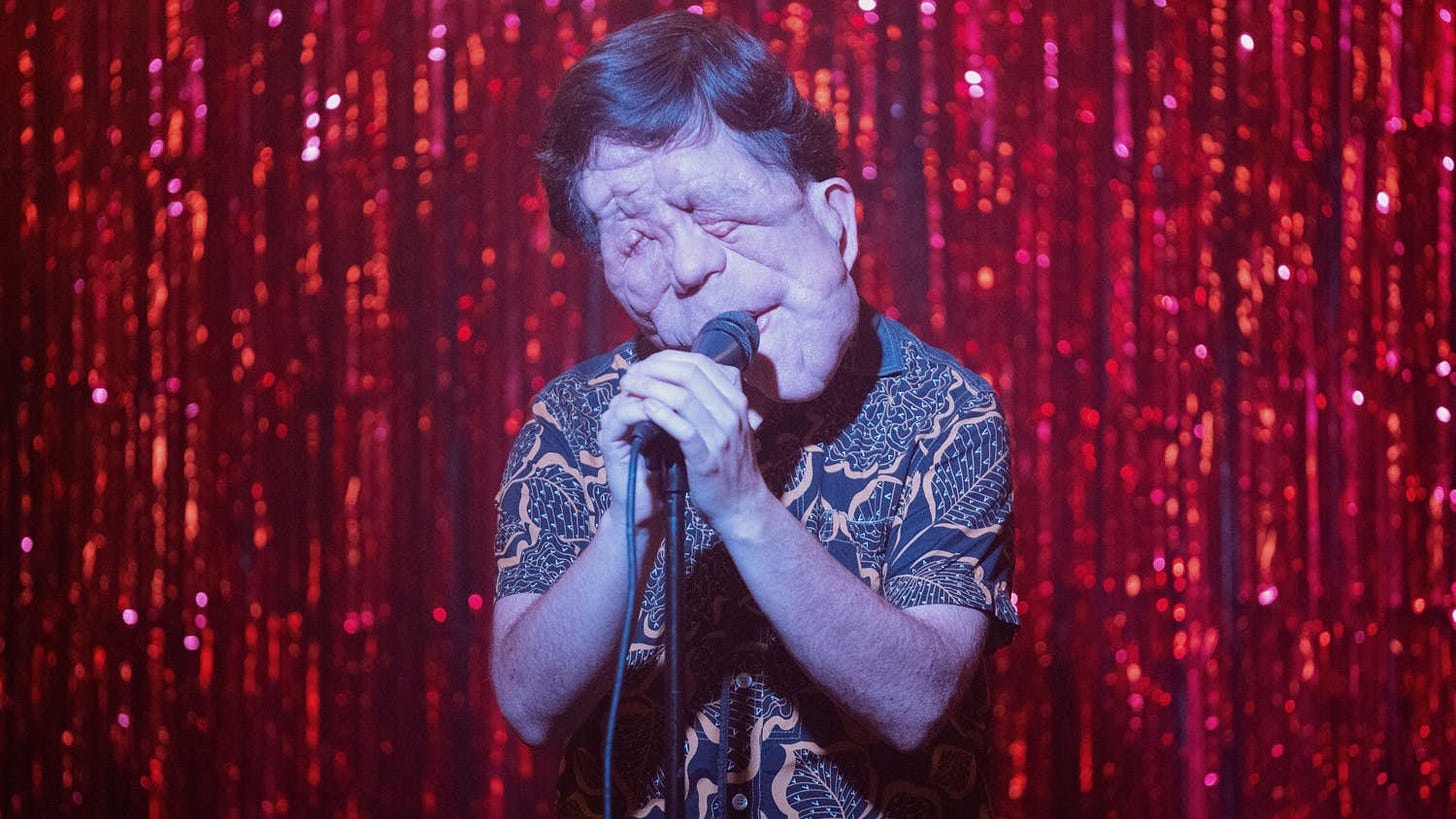 A Different Man Review – 'A darkly hilarious satire'