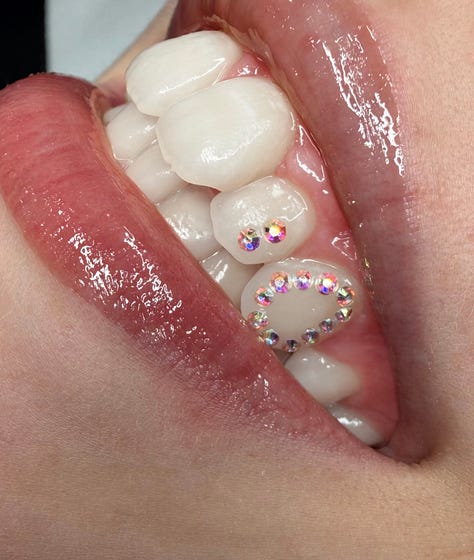 tooth gems italy milan kola payer