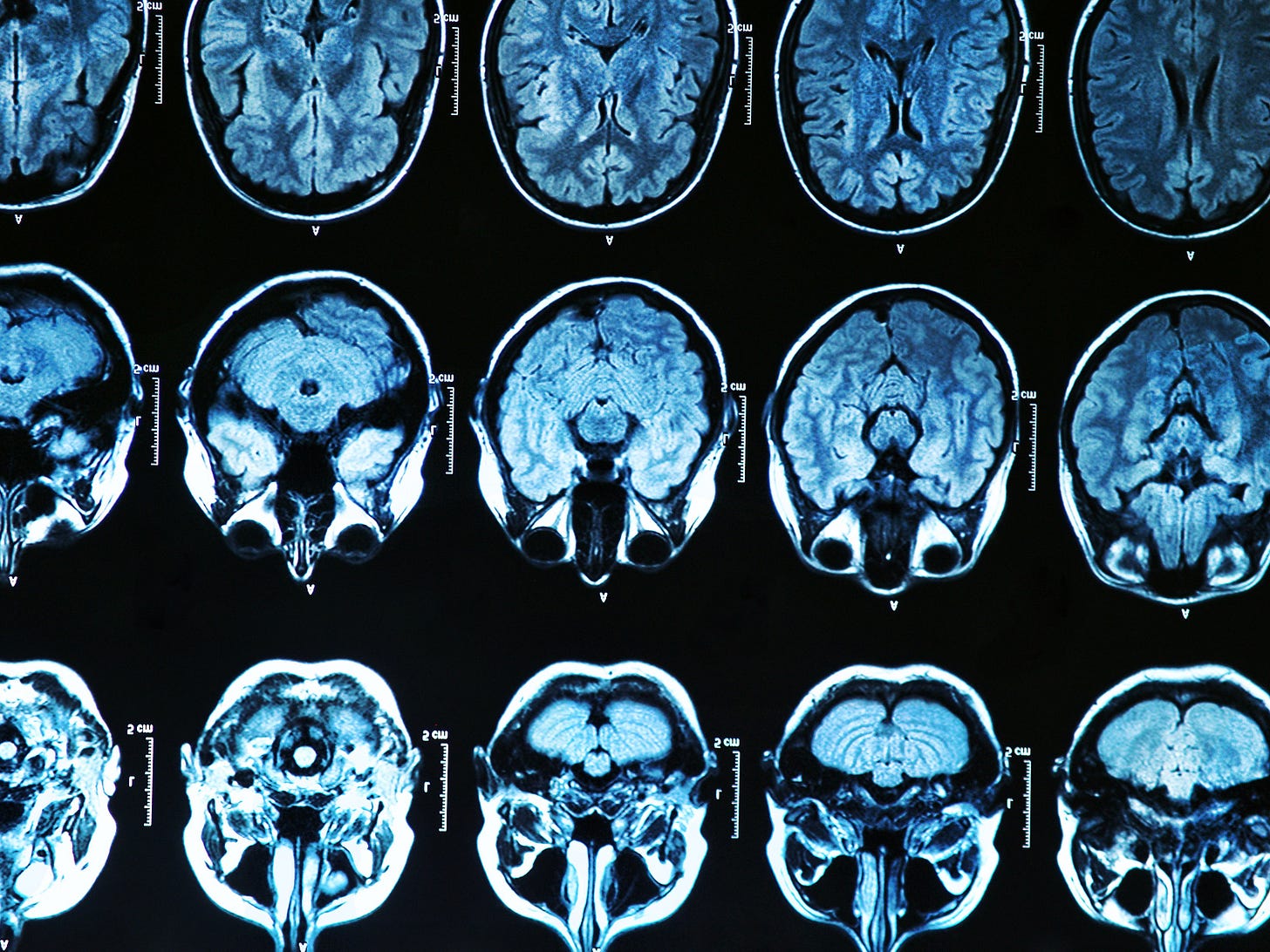 Your Brain Expands and Shrinks over Time: These Charts Show How |  Scientific American