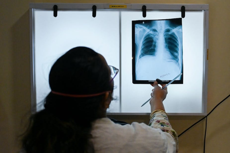 A woman in a white coat examining a chest x-ray on a lit-up screen A woman in a white coat examining a chest x-ray on a lit-up screen