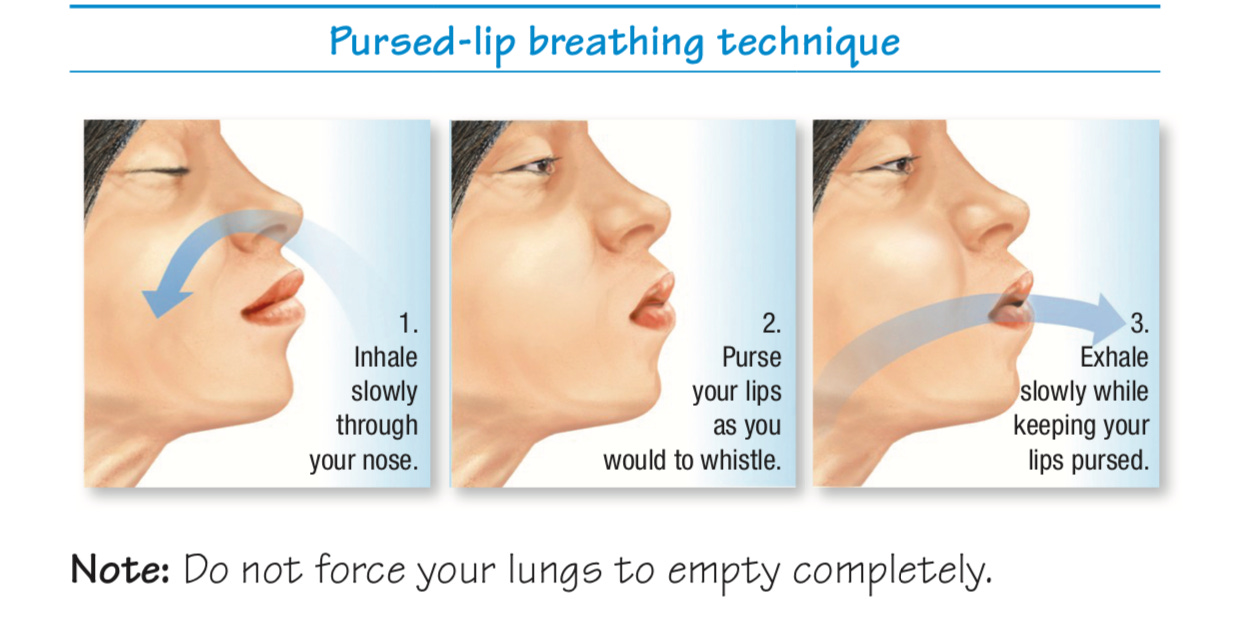 Pursed-Lip Breathing — Vigor Health