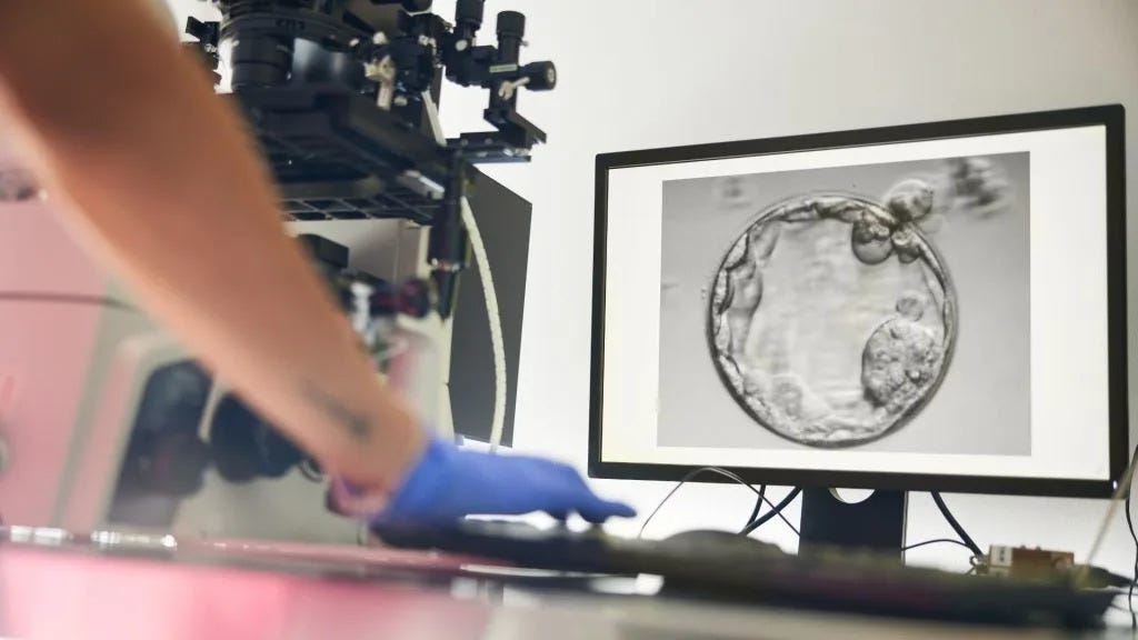 AI finds hidden sperm in man thought infertile, couple gets pregnant after 18 years AI finds hidden sperm in man thought infertile, couple gets pregnant after 18 years